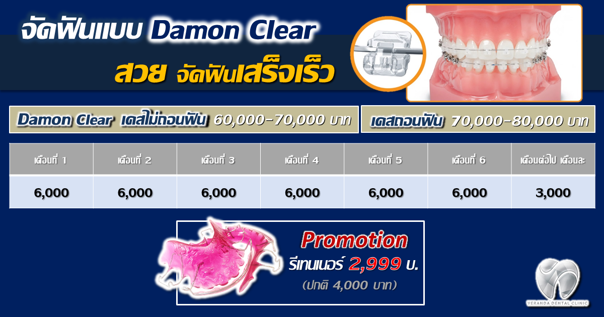 Promotion Damon Clear