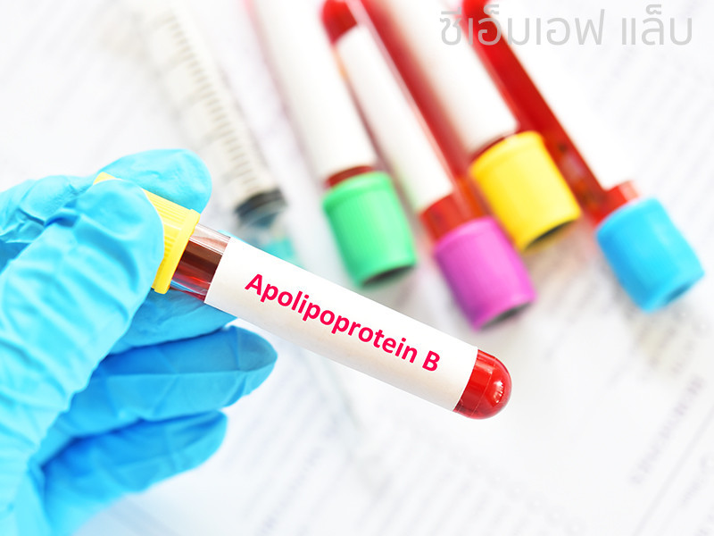 ตรวจ Apolipoprotein B