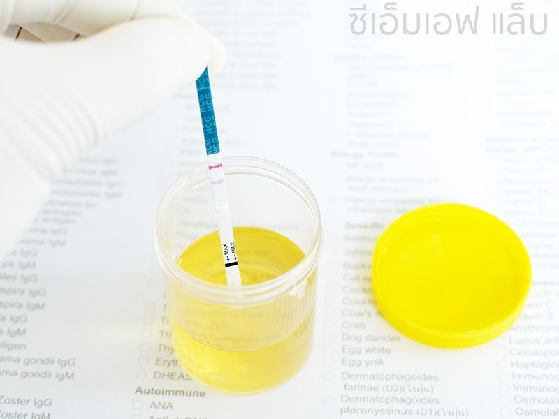 ตรวจการตั้งครรภ์จากปัสสาวะ (Urine Pregnancy Test)